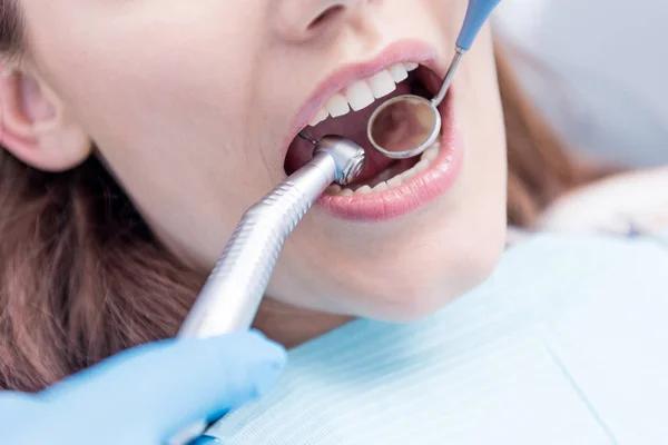 Restore Function and Appearance with Dental Implants in Abbotsford